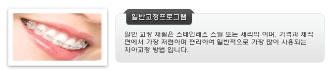 일반교정 재질은 스테인레스 스틸 또는 세라믹 이며, 가격과 제작 면에서 가장 저렴하며 편리하여 일반적으로 가장 많이 사용되는 치아교정 방법 입니다.